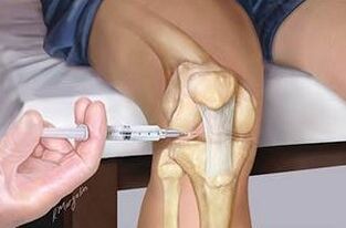 Injection par Hyaluron